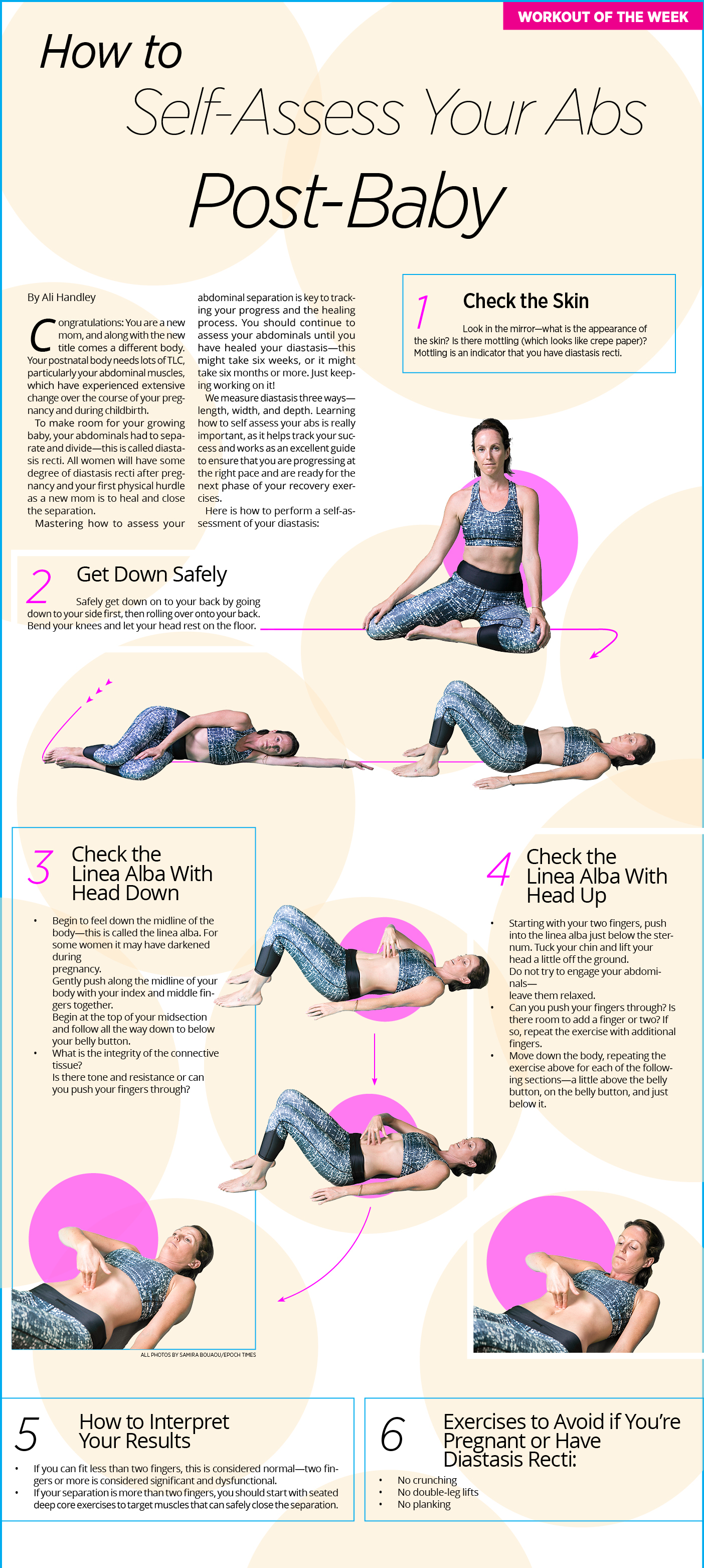 Assessing for Diastasis Recti