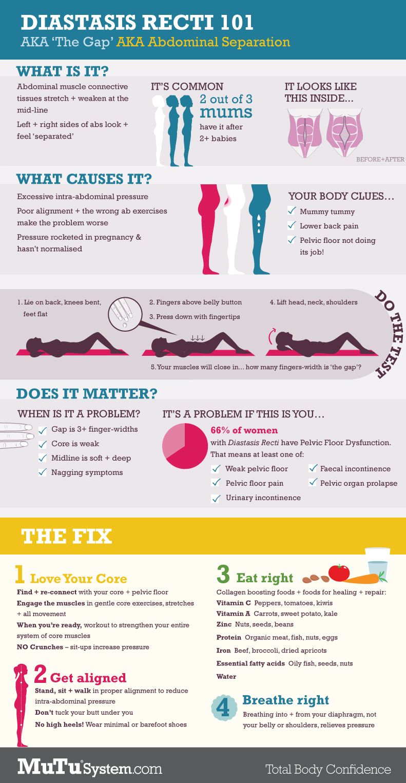 Belly Wrap Diastasis Recti